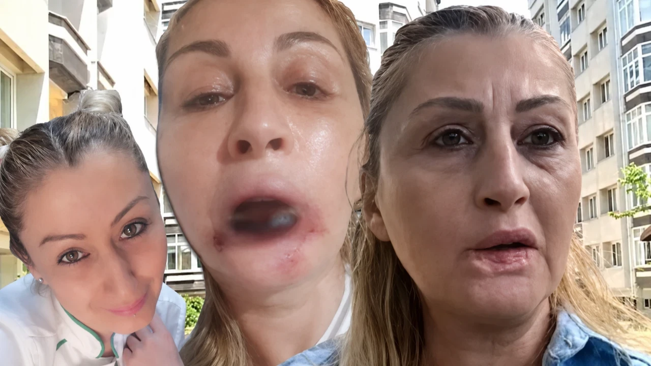 Estetik uğruna gitti, 7 yıldır mahkeme kapılarında: “Gülüşüm yok, yemek yemek problem”