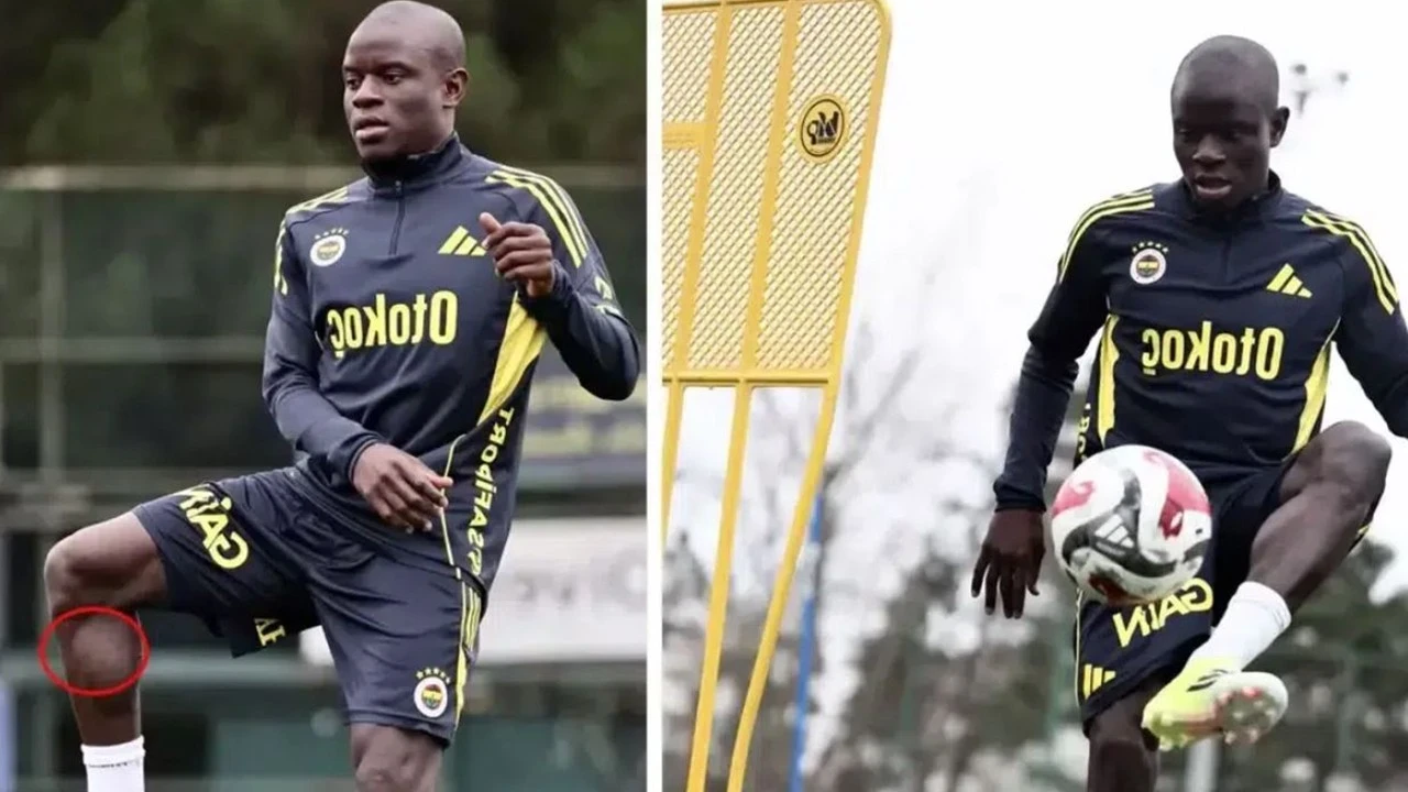 Fenerbahçe'de Kante testten geçti! Çıkan sonuç herkesi şaşırttı