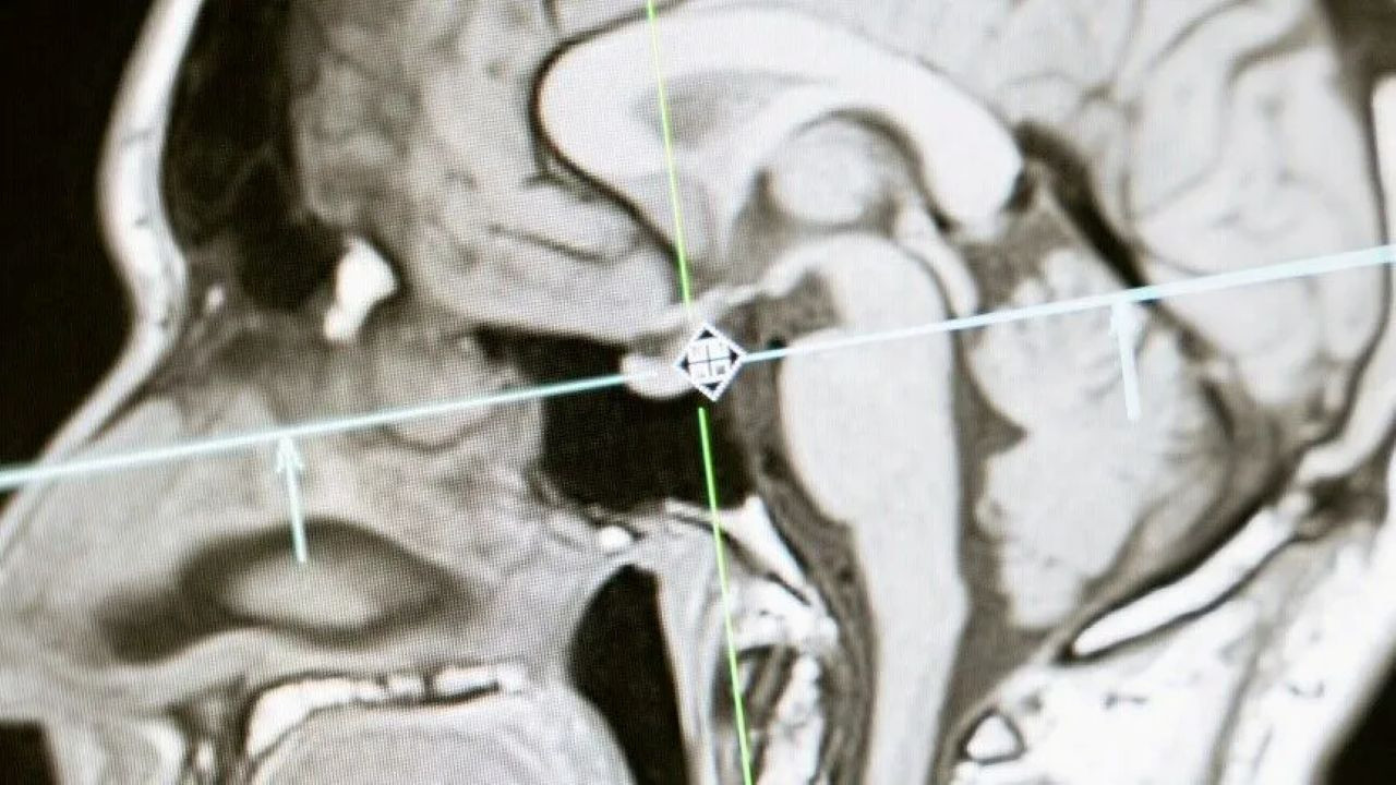 Hindistan'da araştırmacılar, beyin kökünün 3 boyutlu en detaylı atlasını oluşturdu