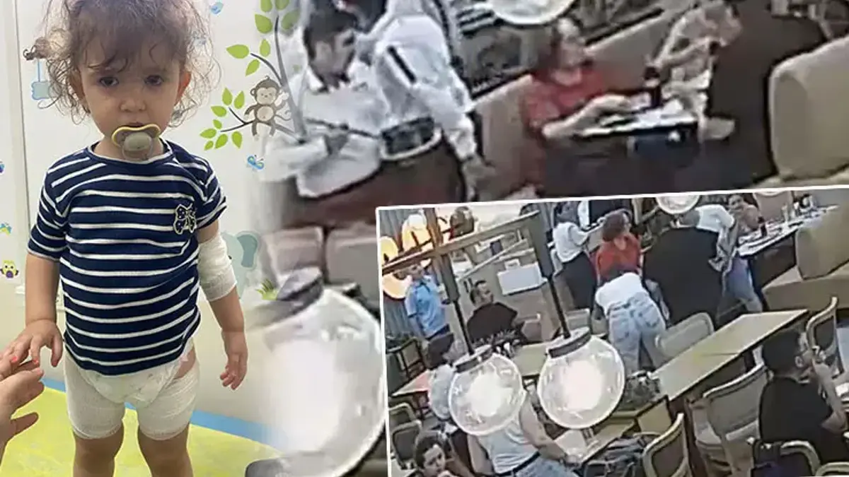 Restoranda korkunç kaza! Tava sapı bir anda koptu, küçük Mercan'ın üzerine kızgın yağ döküldü