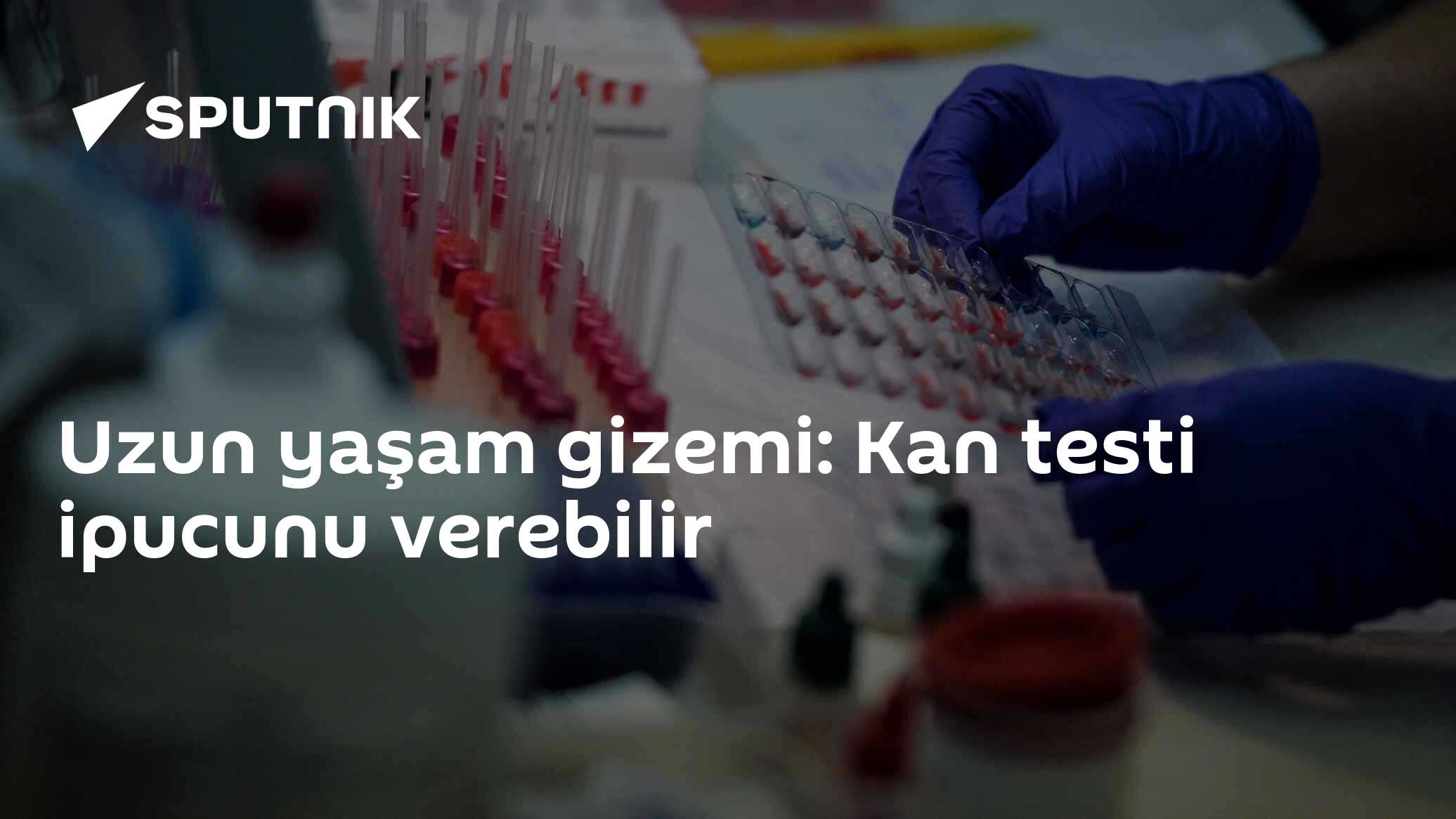 Uzun yaşam gizemi: Kan testi ipucunu verebilir