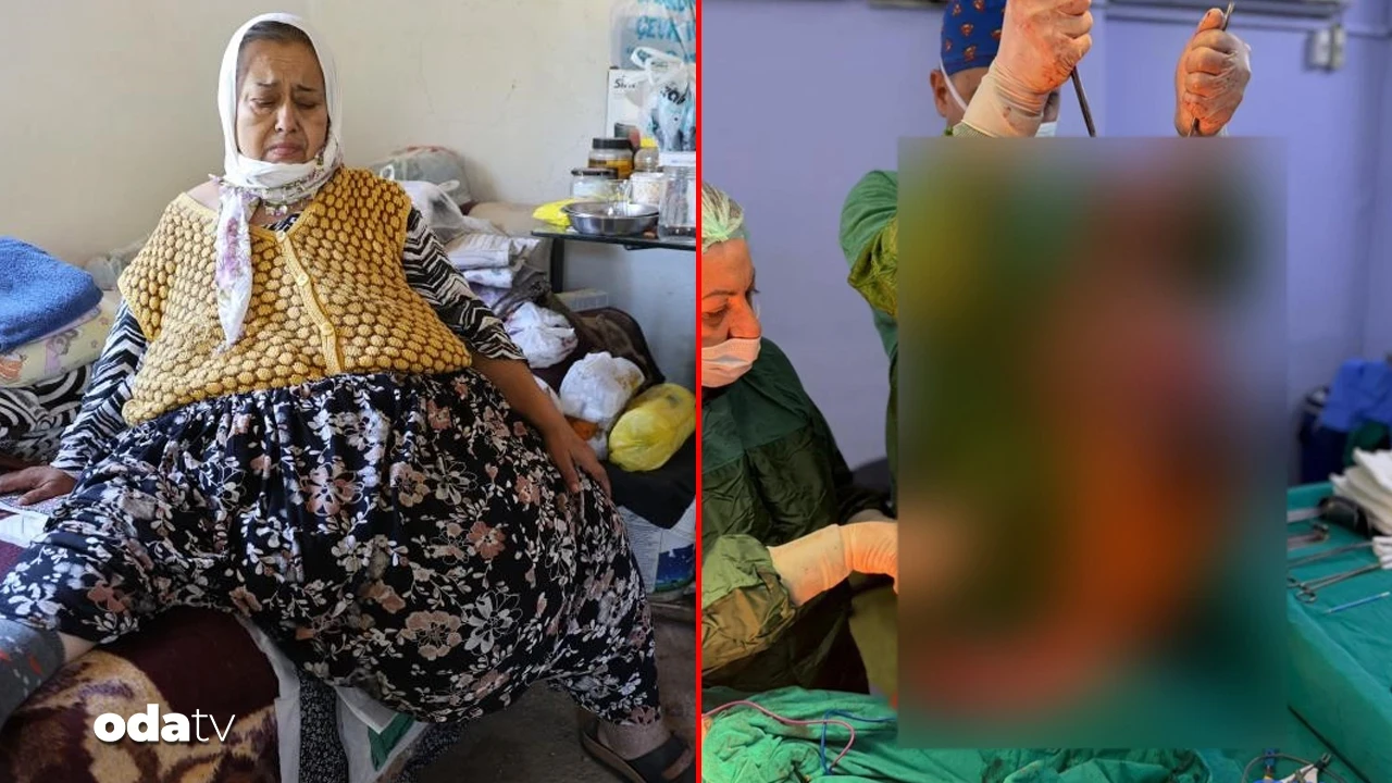 Aydınlı kadının 33 yıllık kabusu bitti: Karnından 40 kilo kitle çıkarıldı
