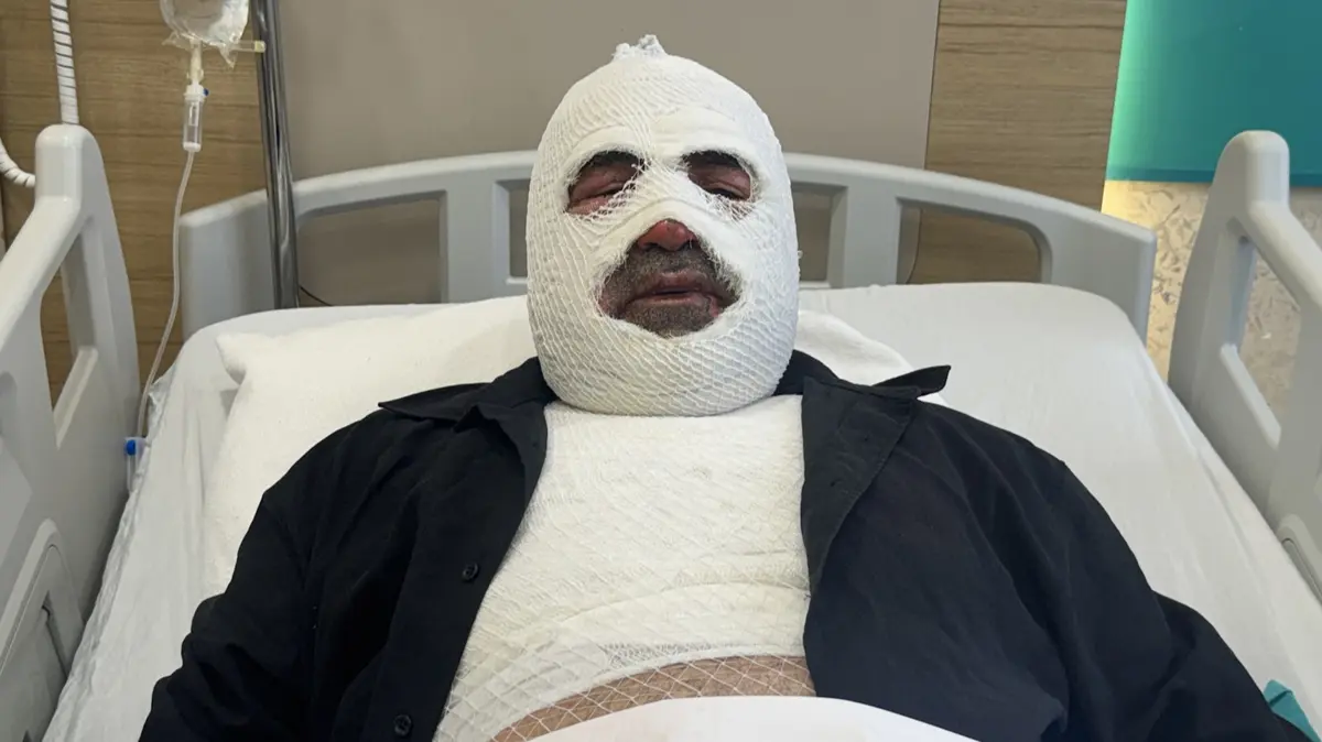 Bir anlık hata canından ediyordu: Ben yandım başkaları yanmasın