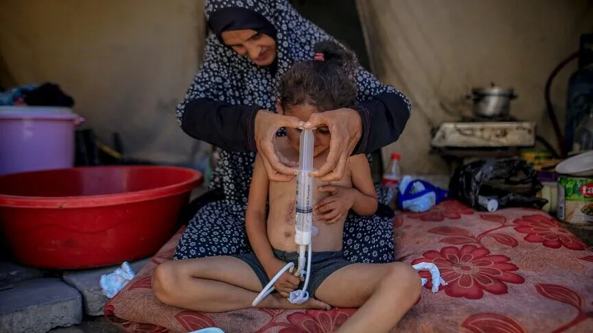 4 yaşındaki Gazzeli Necva’nın hayata tutunması, İsrail ablukasının ardındaki bir ameliyata bağlı