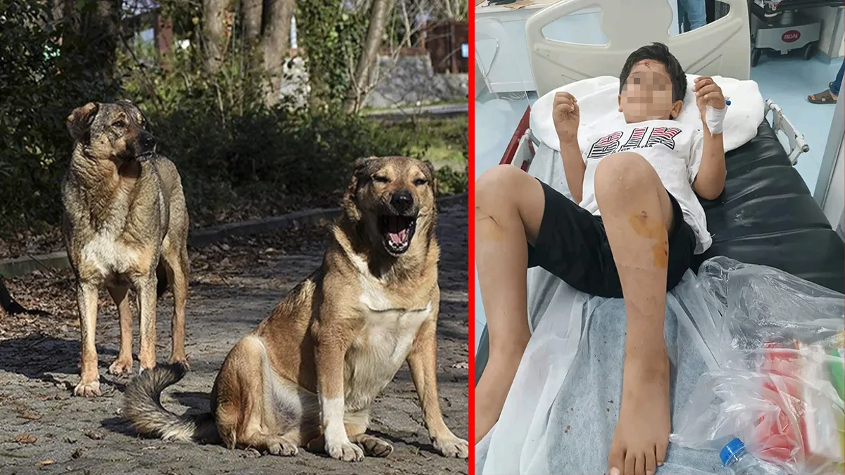 Şanlıurfa’da korkunç olay! Başıboş sokak köpeklerinin saldırısına uğradı: Minik Abdulkadir yaralandı!