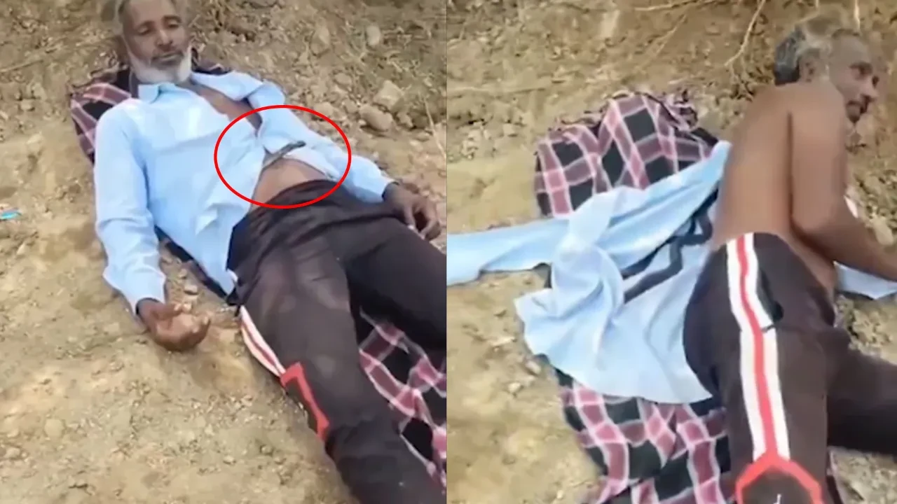 Gömleğinin içine giren kobradan ısırılmadan böyle kurtuldu