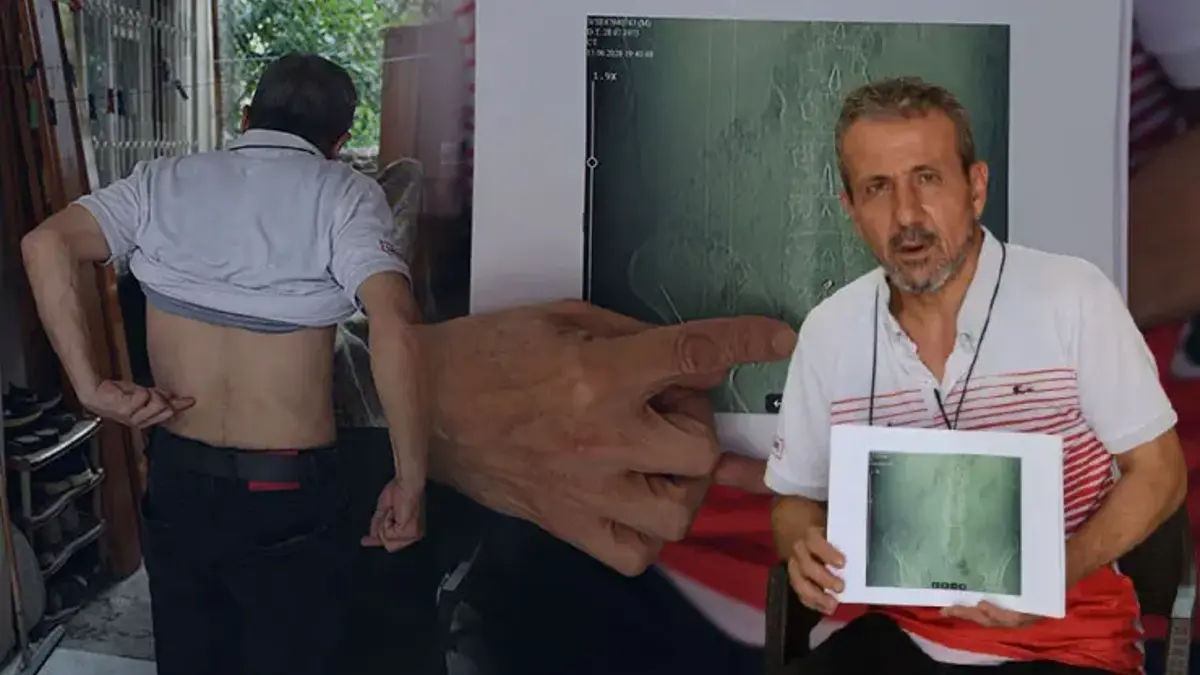 Ameliyat masasında kabus! Doktor önce inanmadı, sonra kabul etti: Riski göze almıyorlar