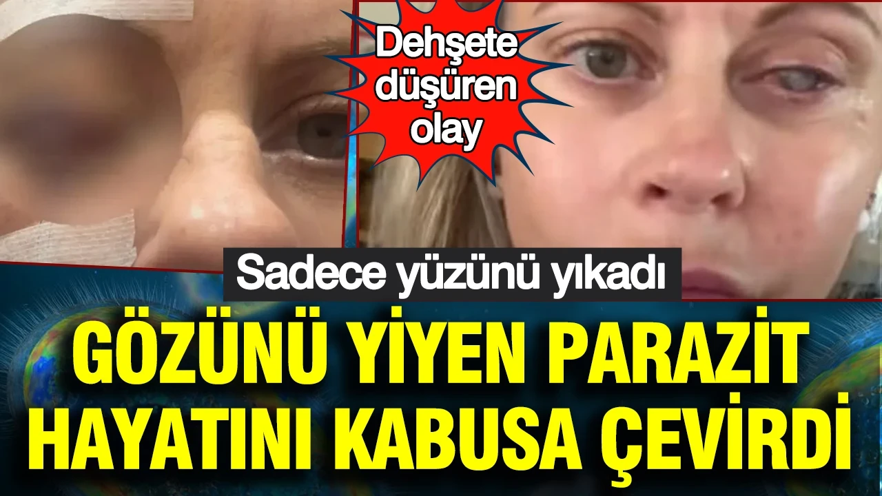 Dehşete düşüren olay: Sadece yüzünü yıkadı, gözünü yiyen parazit hayatını kabusa çevirdi