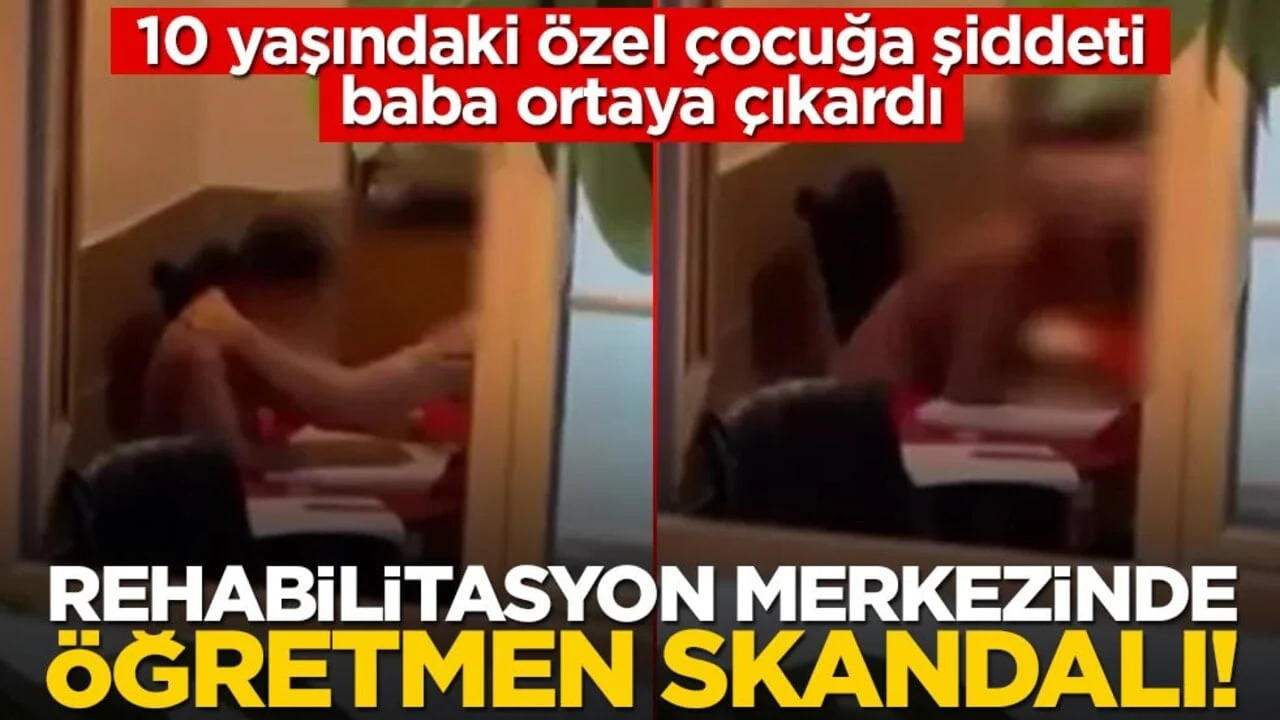 10 yaşındaki özel çocuğa şiddeti baba ortaya çıkardı! Rehabilitasyon merkezinde öğretmen skandalı!