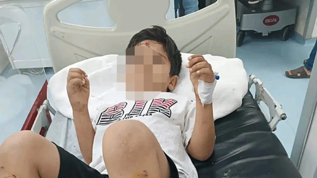 8 yaşındaki Abdulkadir Sarık sokak köpeklerinin saldırısında yaralanmıştı: Bakan Çiftçi'den 'inceleme' talimatı!