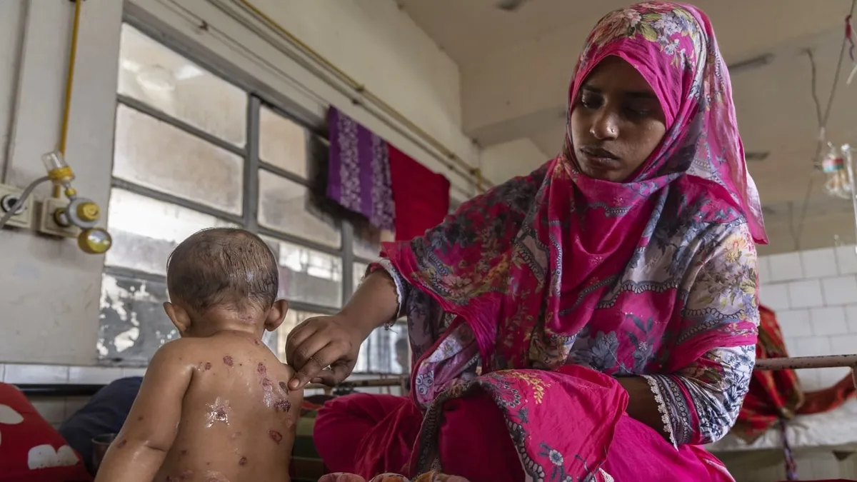 Bangladeş'teki kızamık salgınında hayatını kaybeden çocukların sayısı 712'ye yükseldi
