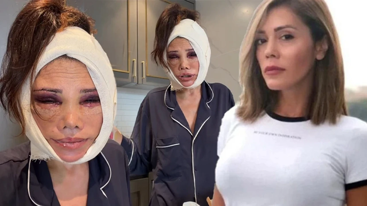 Estetik için gitti, kâbusu yaşadı! Eski Survivor yarışmacısından ‘kölelik anlaşması’ iddiası