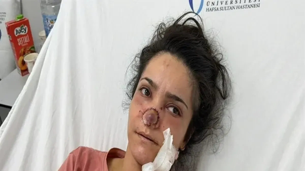 Manisa'da herkesi şoke eden olay! Eşinin burnunu koparmıştı… Cani eşe karar çıktı