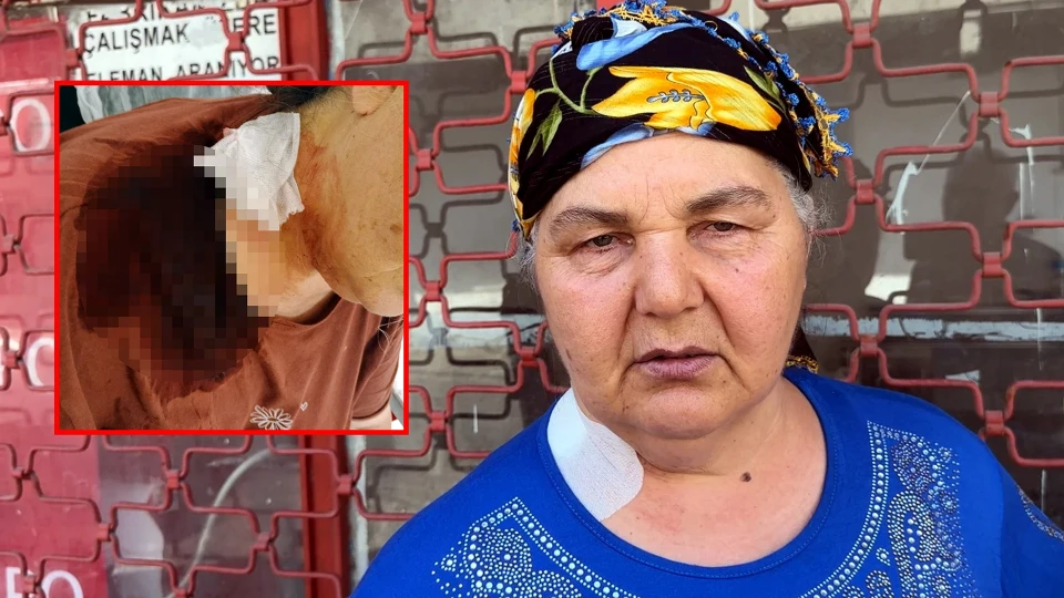 Avcılar'da 26 yıl önce boşandığı eşini boynundan bıçakladı: 'Yüzünü unutmuşum, tanıyamadım'