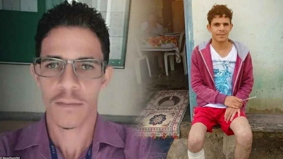 Brezilya'da film gibi sigorta dolandırıcılığı: 13 milyon TL alabilmek için kendi ayağını kesti!