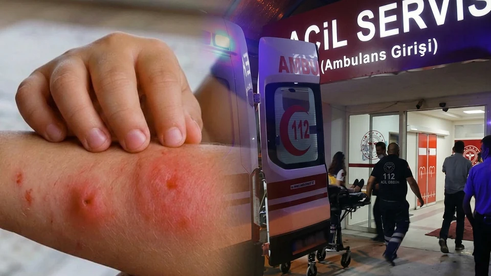 Asya Kaplan Sivrisineği ısırığı nasıl anlaşılır? Uzman isim çocuklarda görülen dev şişlik ve iltihaplı yaraları anlattı | SAĞLIK HABERLERİ