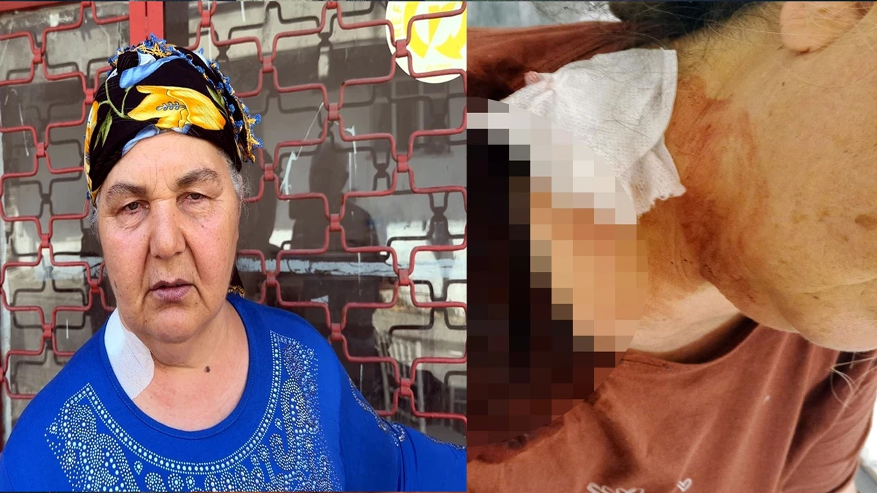 Yüzünü unuttuğu eski eşi iş yerini bastı: "Benim derdim seninle" diyerek bıçakladı
