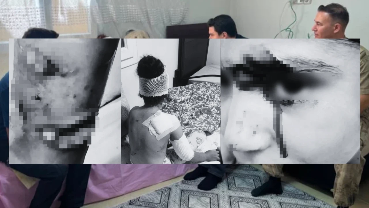 Şanlıurfa'da sokak köpeklerinin saldırdığı 8 yaşındaki çocuk yaralandı