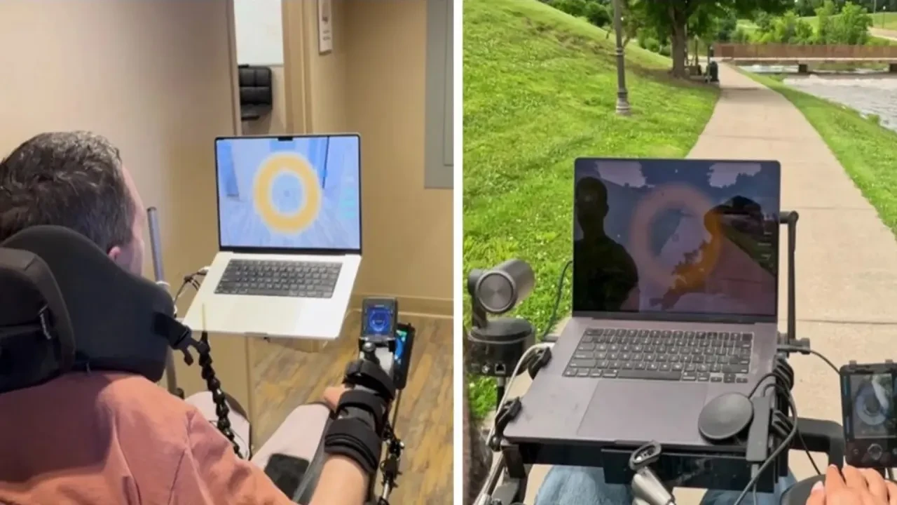 Beyin implantı takılan felçli hasta, düşünerek tekerlekli sandalye sürdü