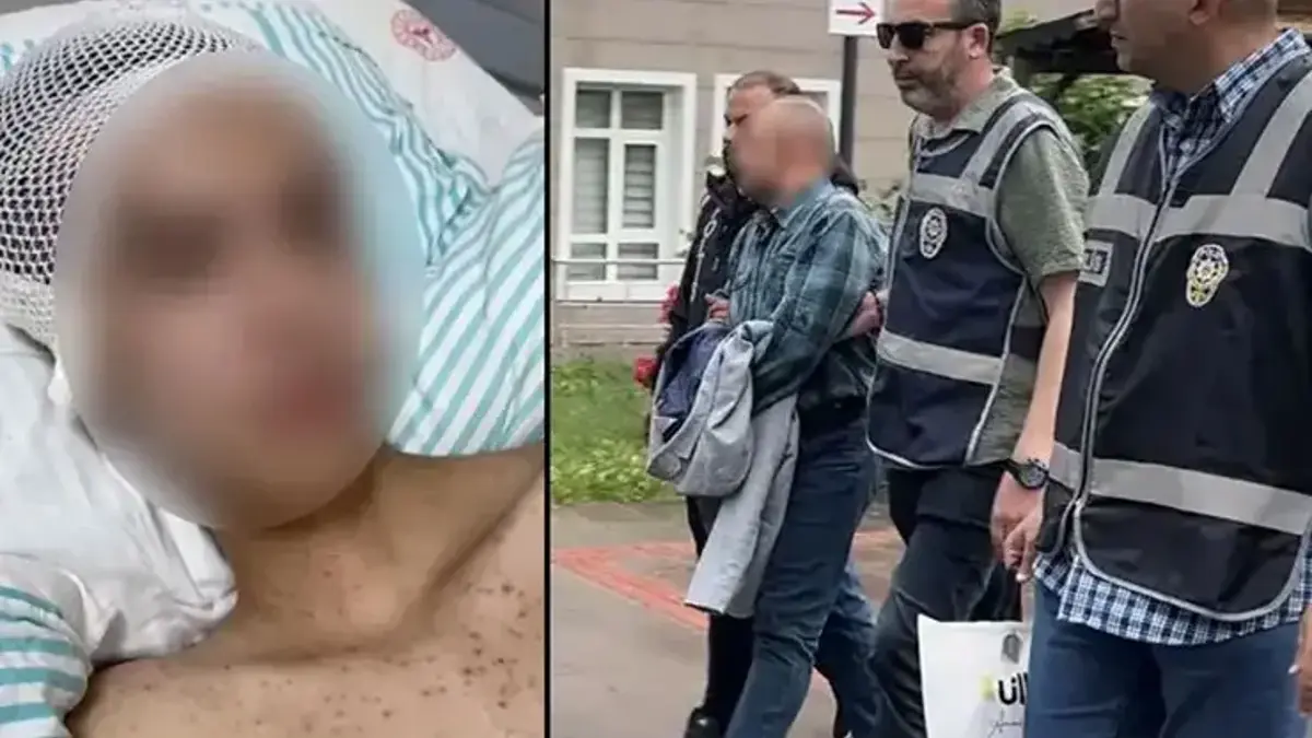 Tacize direnince başından vuruldu! 14 yaşındaki çocuk felç kaldı