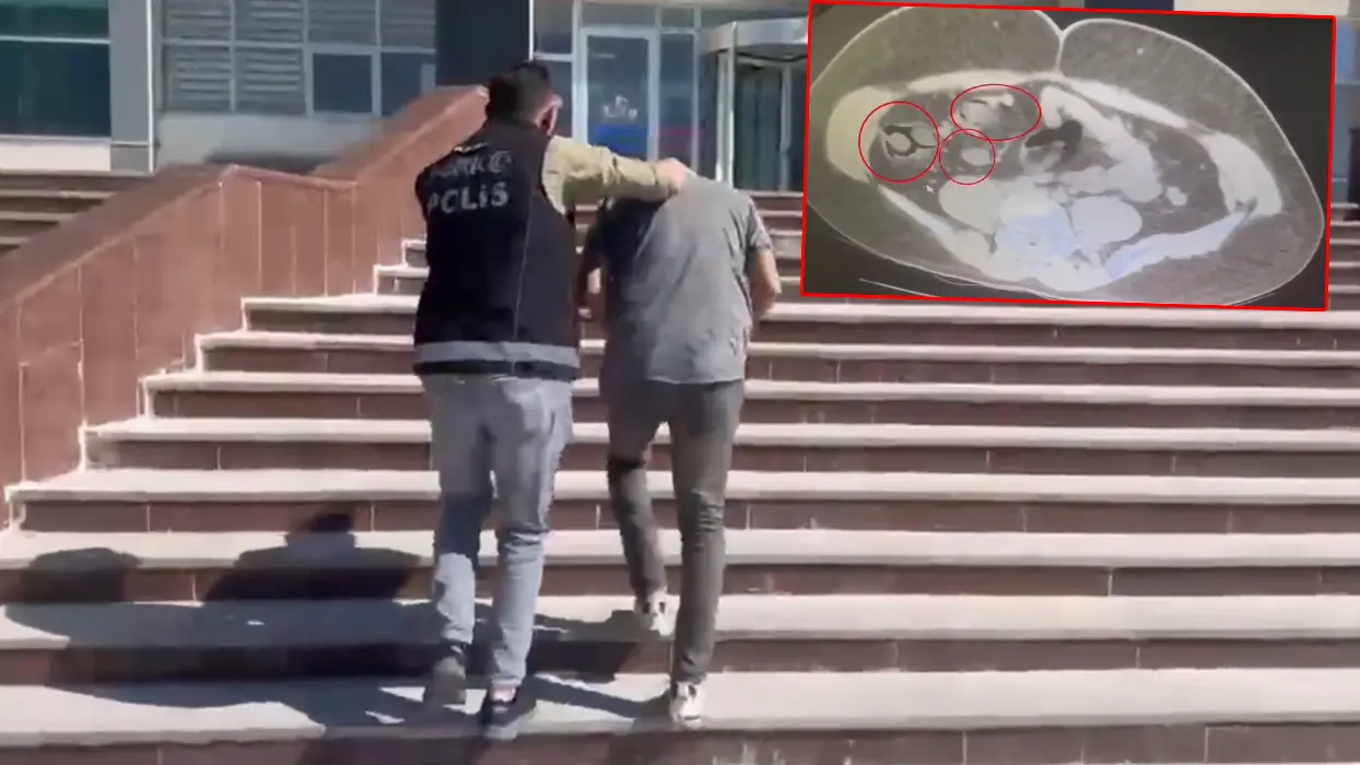 Zehir tacirinden 'pes' dedirten yöntem! Gerçek x-ray'de ortaya çıktı