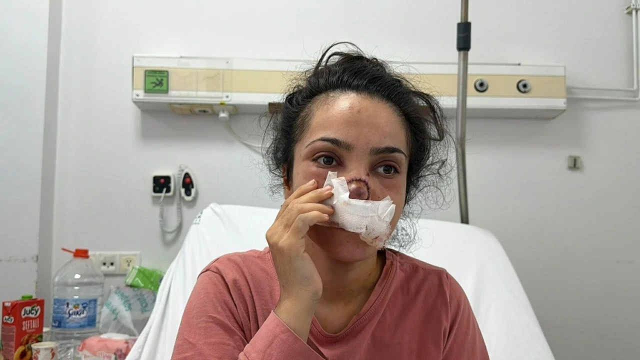 Eşi burnunu ısırıp koparmıştı! Genç kadın yaşadığı vahşeti anlattı: Balkondan atlamayı düşündüm