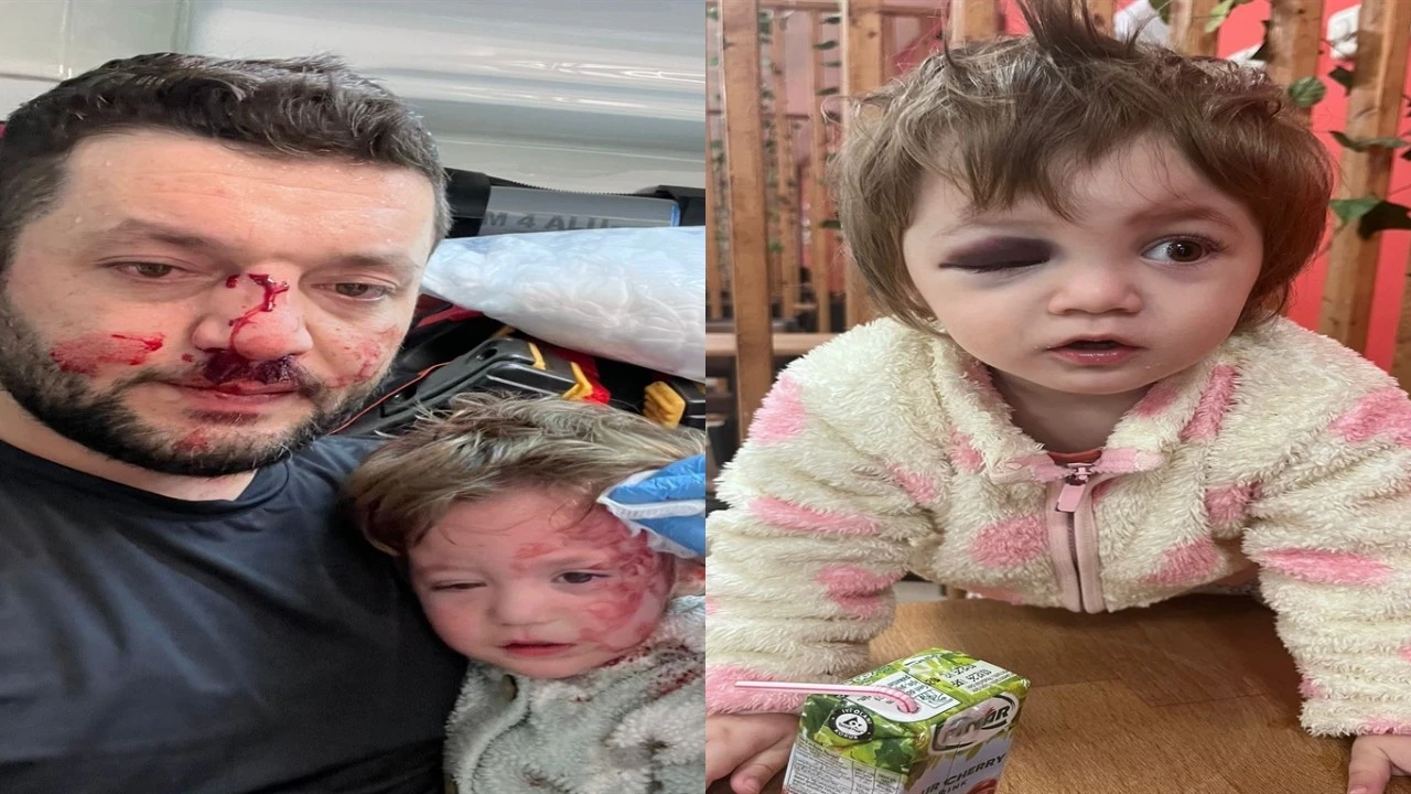 Kucağında bebeği olan babayı darbeden sanık adli kontrolle tahliye edildi