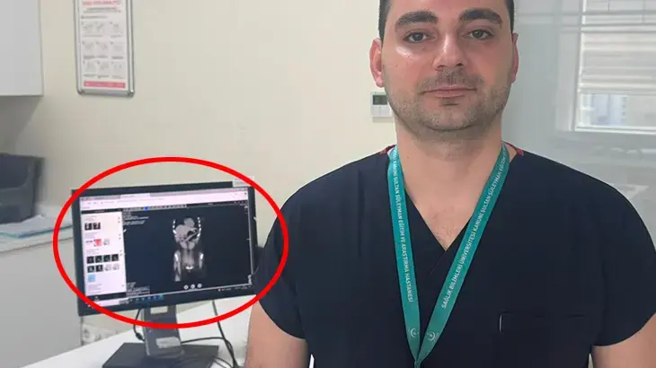Zayıflamak uğruna kendine bunu yaptı! İstanbul'da doktorların inanamadığı vaka