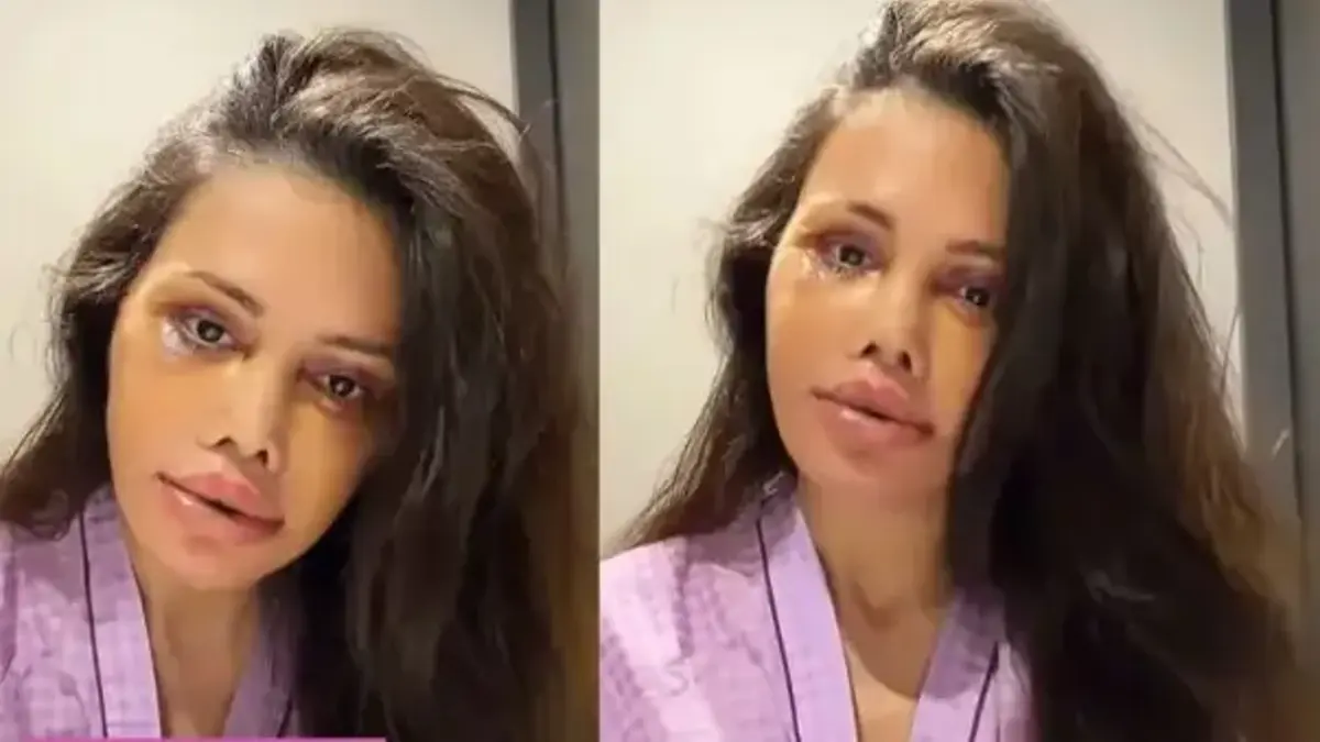 İkinci kez kapsamlı yüz operasyonu geçirmişti! Didem Ceran'dan duygusal paylaşım: "En iyi niyetli olduğum yerlerden cezalandırıldım"