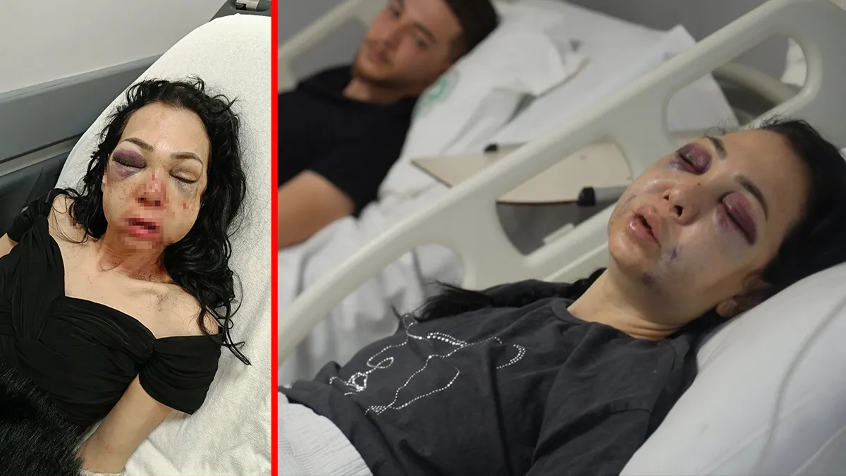 İzmit’teki kafede oğluyla birlikte öldüresiye darp edilmişti! Saldırganlar hakim karşısında: ‘Yüzündeki kemikleri kırıp…’