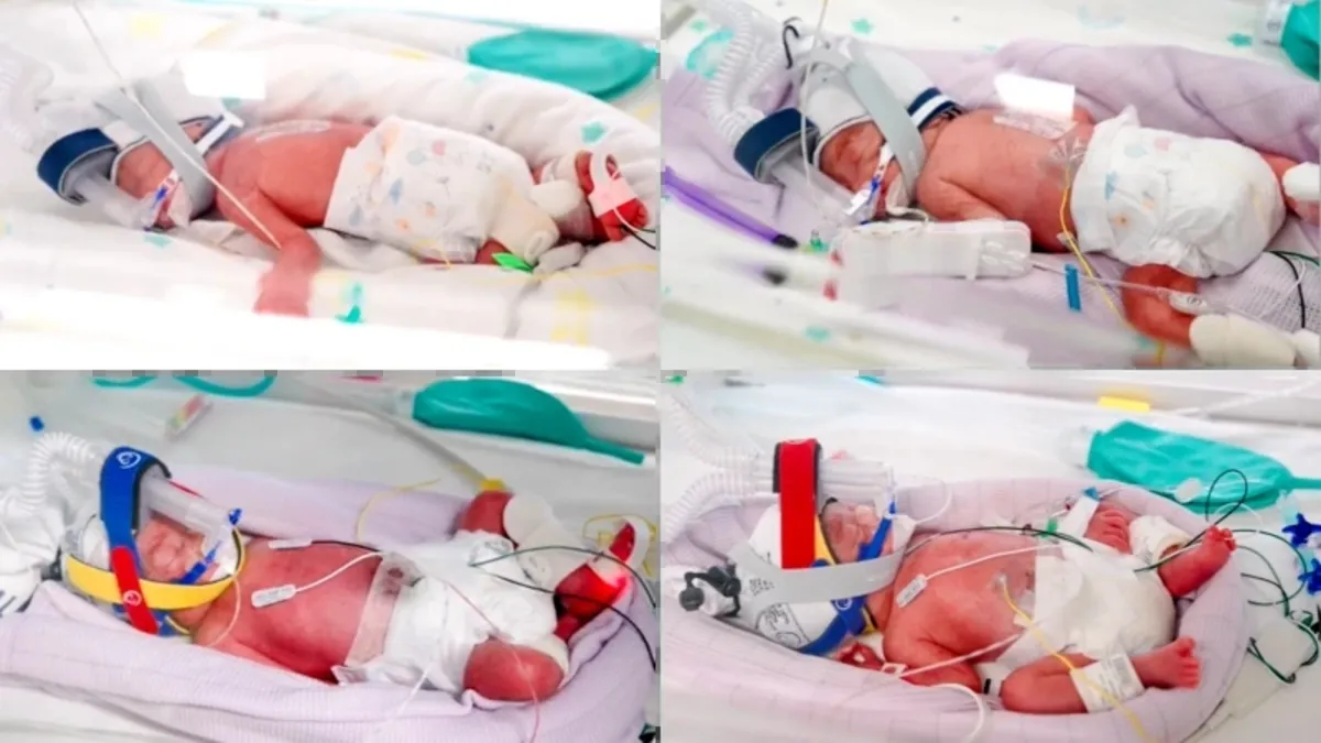 Ülke tarihinde ilk! 15 milyonda bir: Tek yumurta dördüzleri dünyaya geldi