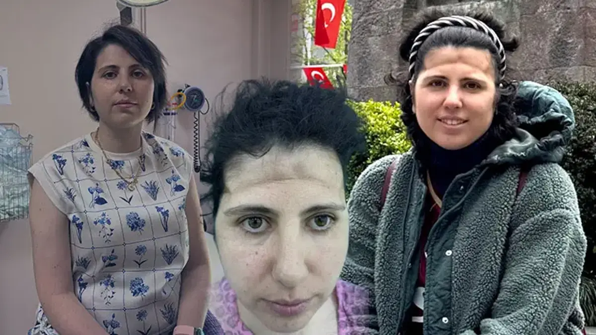 Baş ağrısıyla gitti, alnı çöktü! 'Eski fotoğraflarıma bakarak karar verdim'