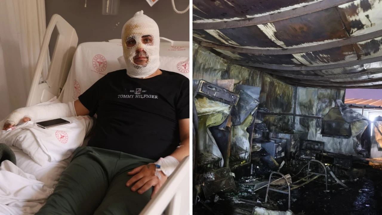 Ekmek teknesi için alevlerin arasına daldı, patlamayla yüzü yandı