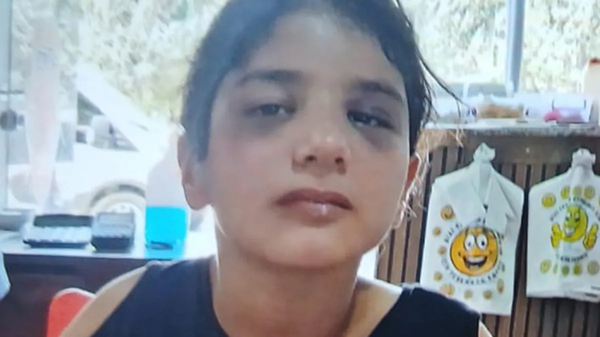 Bakanlıktan darp edilen otizmli çocuğa destek