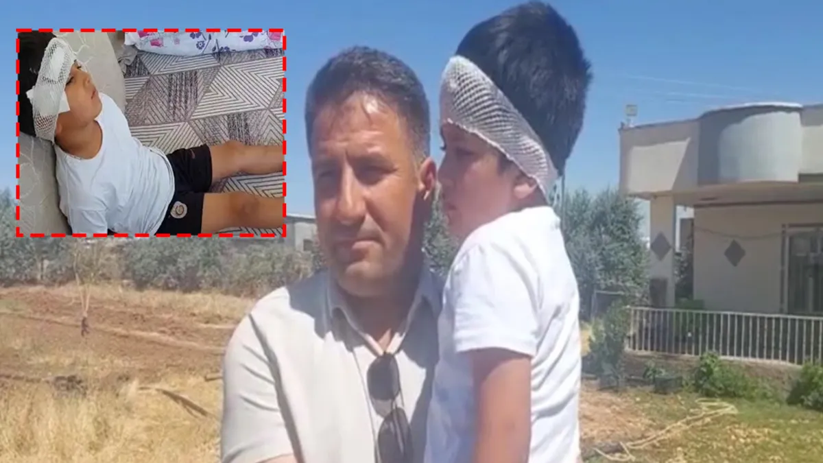 Şanlıurfa'da korkunç olay! Sokak köpeklerinin saldırısına uğramıştı: "Babam ve amcam kurtardı!"
