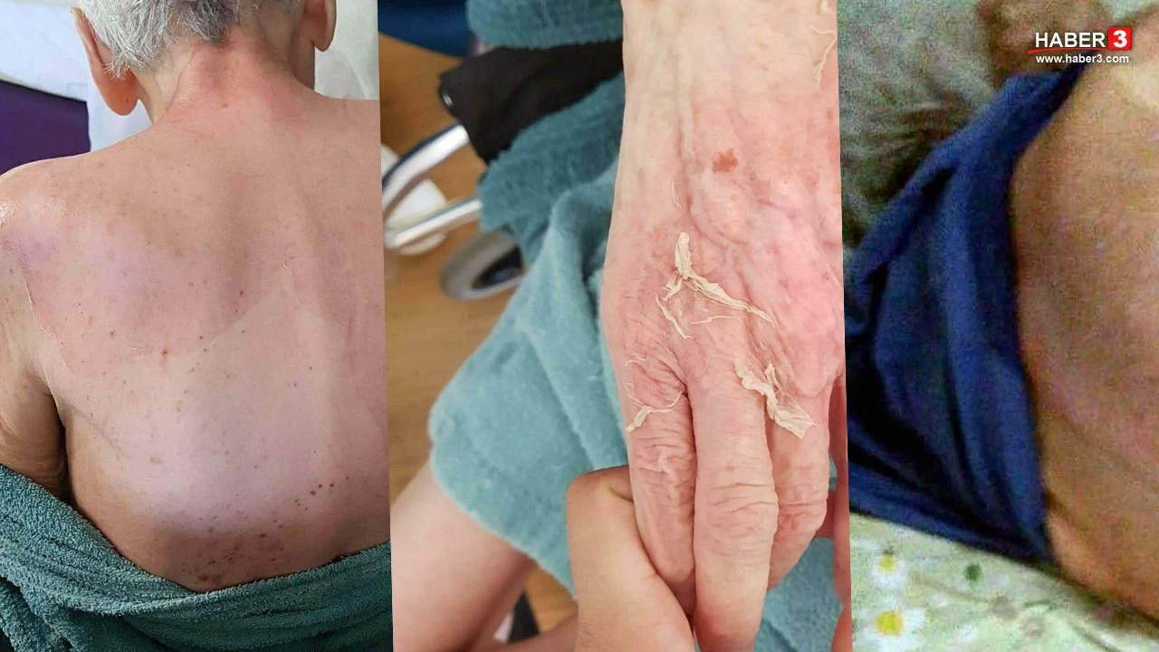 Huzurevinde ölümde verilen ve tepki çeken taksitli 21 bin TL'cik cezanın gerekçesi belli oldu
