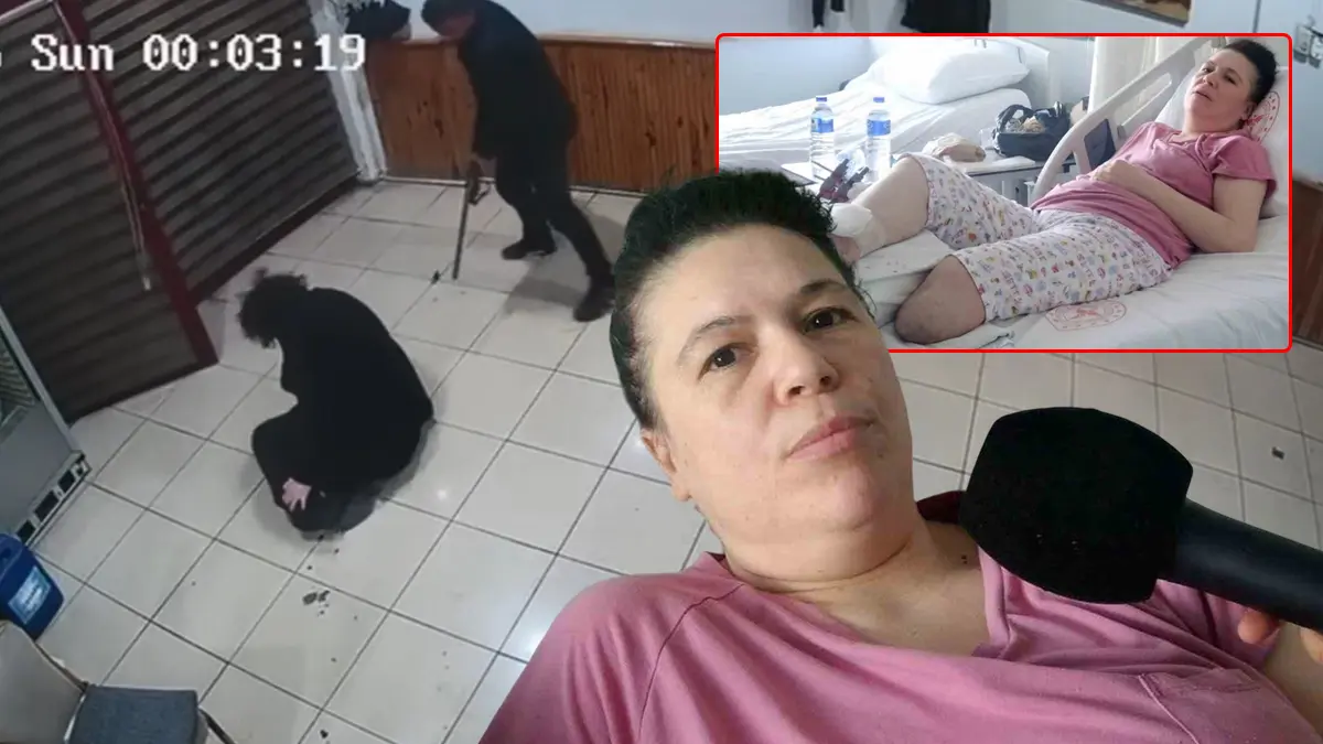 Boşanmak istediği için bacağından oldu