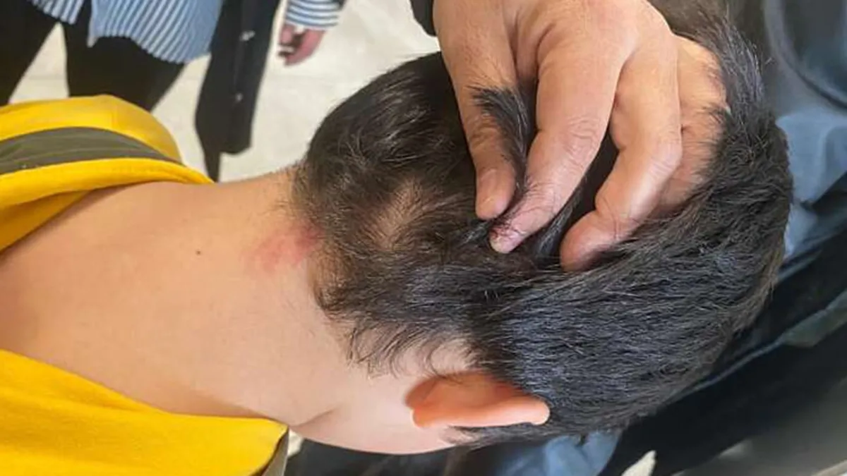 Okulda dehşet! Çocukları temizlik fırçasıyla darp ettiler: İstenen ceza belli oldu