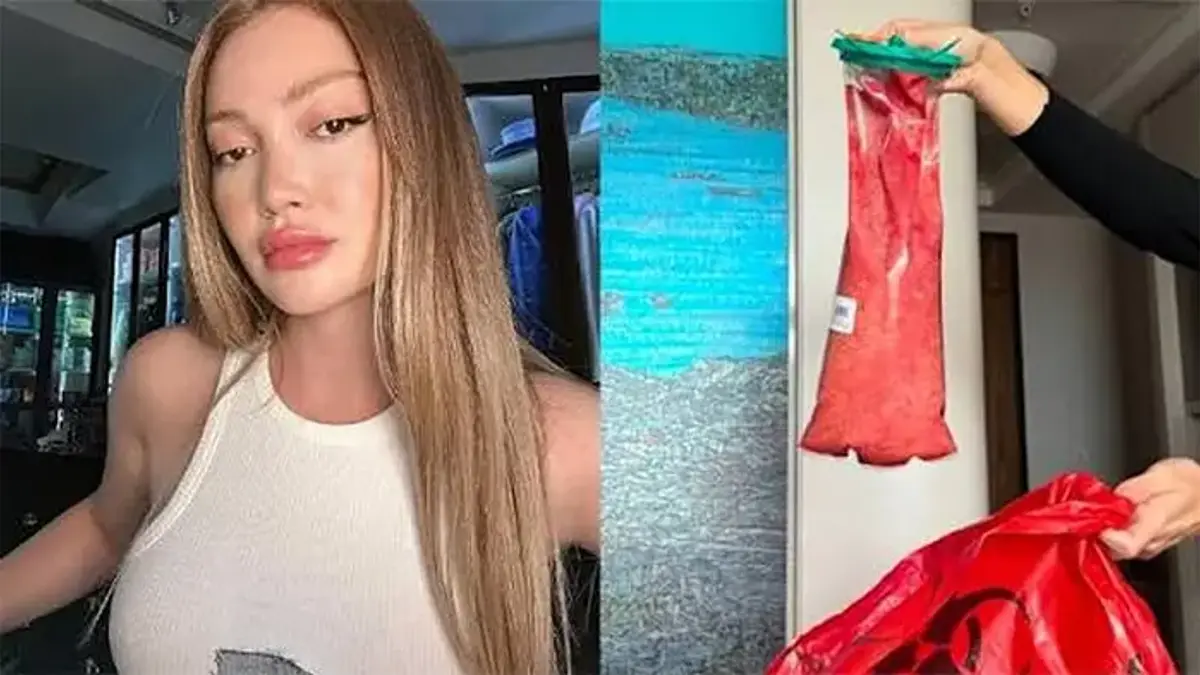 Acil Ameliyata Alınmıştı! Danla Bilic'ten Sağlık Durumu İle İlgili Açıklama: Delireceğim Az Kaldı
