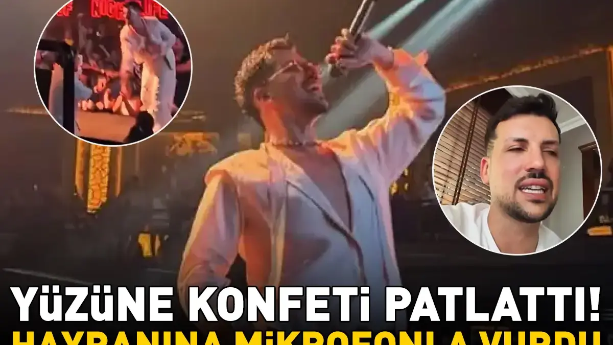 Yüzüne Konfeti Patlattı! Kerimcan Durmaz Hayranına Mikrofonla vurdu! 'Beni Bütün Gece Rahatsız Ettiler'