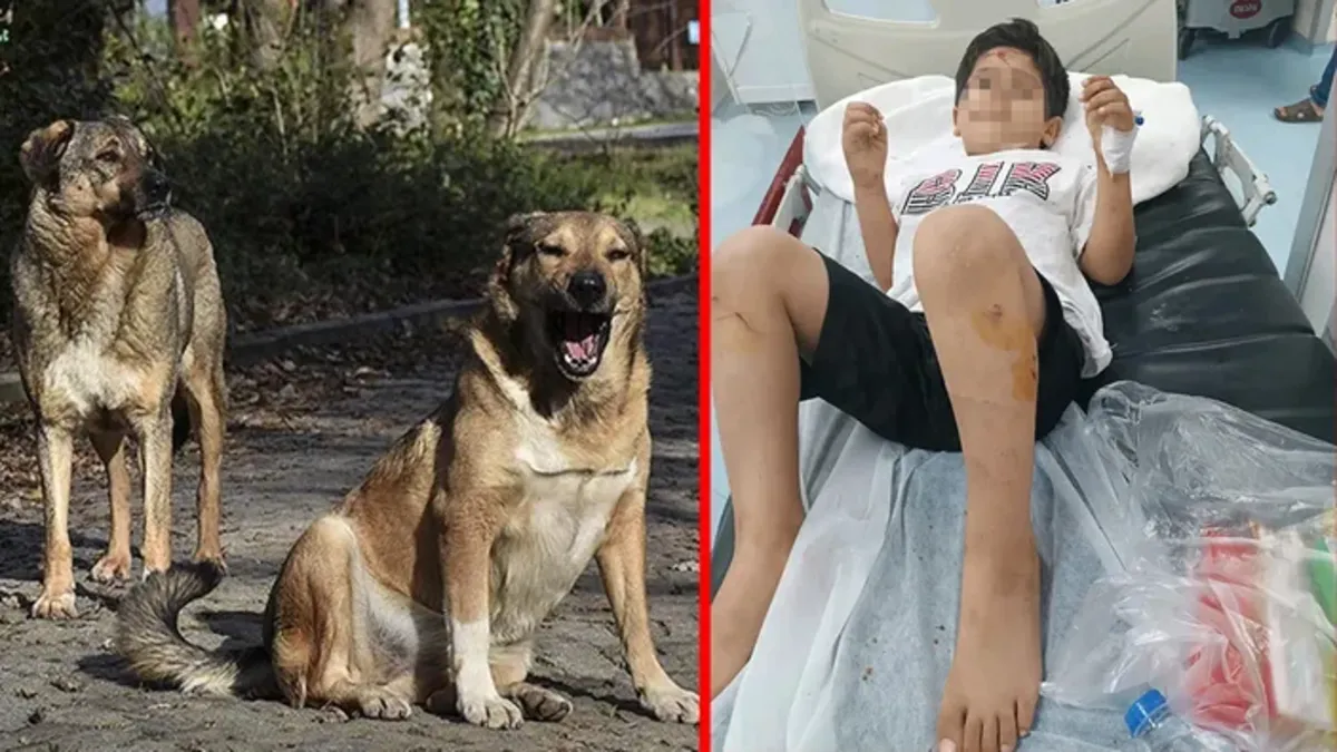 Bakanlık harekete geçti! Viranşehir'deki köpek saldırısına mülkiye müfettişi