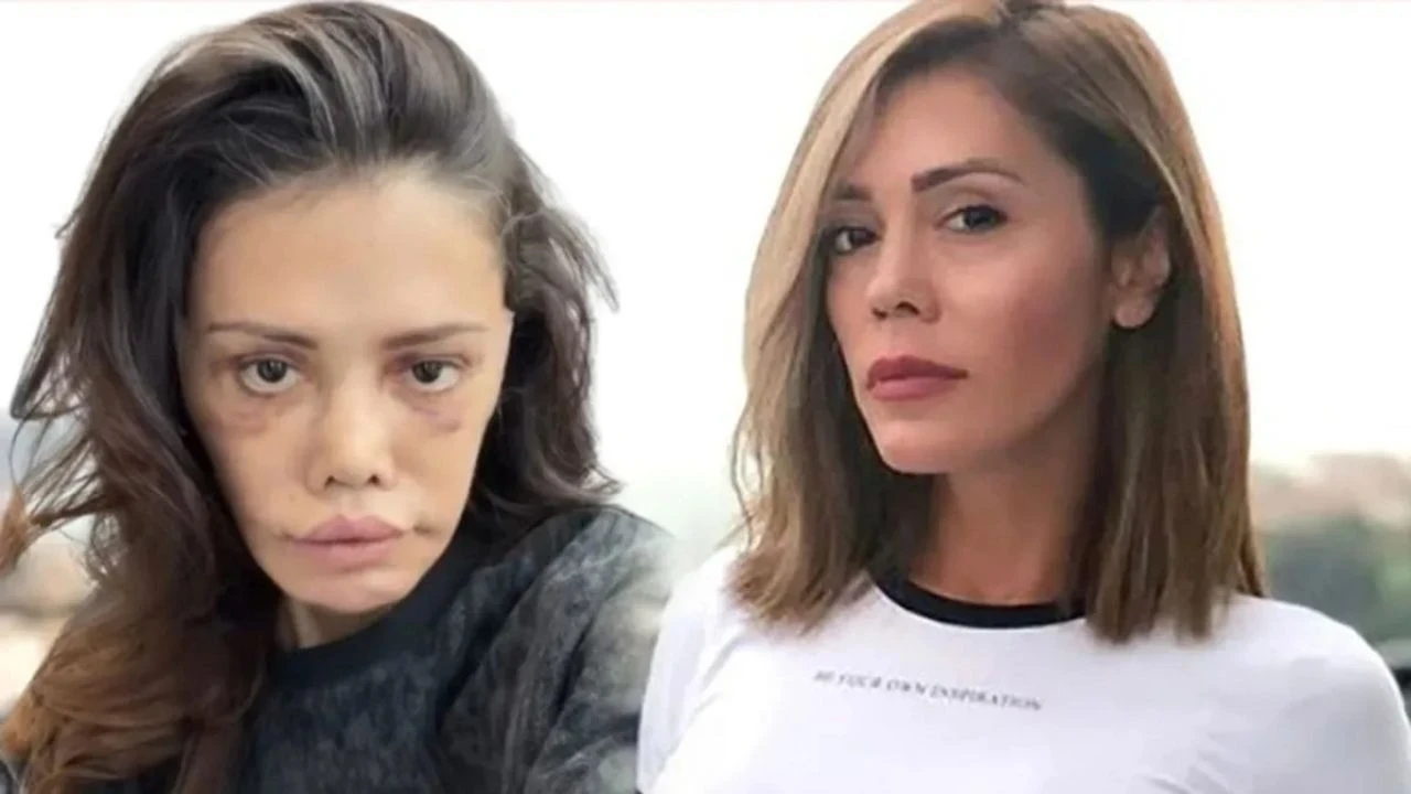 Yeniden bıçak altına yattı, doktorlara isyan etti! Didem Ceran: Dava edeceğim