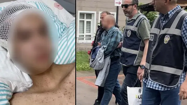 Komadan çıktı, her şeyi anlattı! Tacize direndiği iddiasıyla başından vurulan çocuk felç kaldı