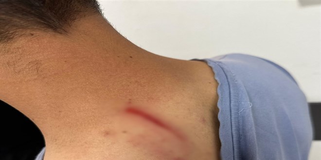 İlaç raporu tartışmasında tıbbi sekreteri darbetti