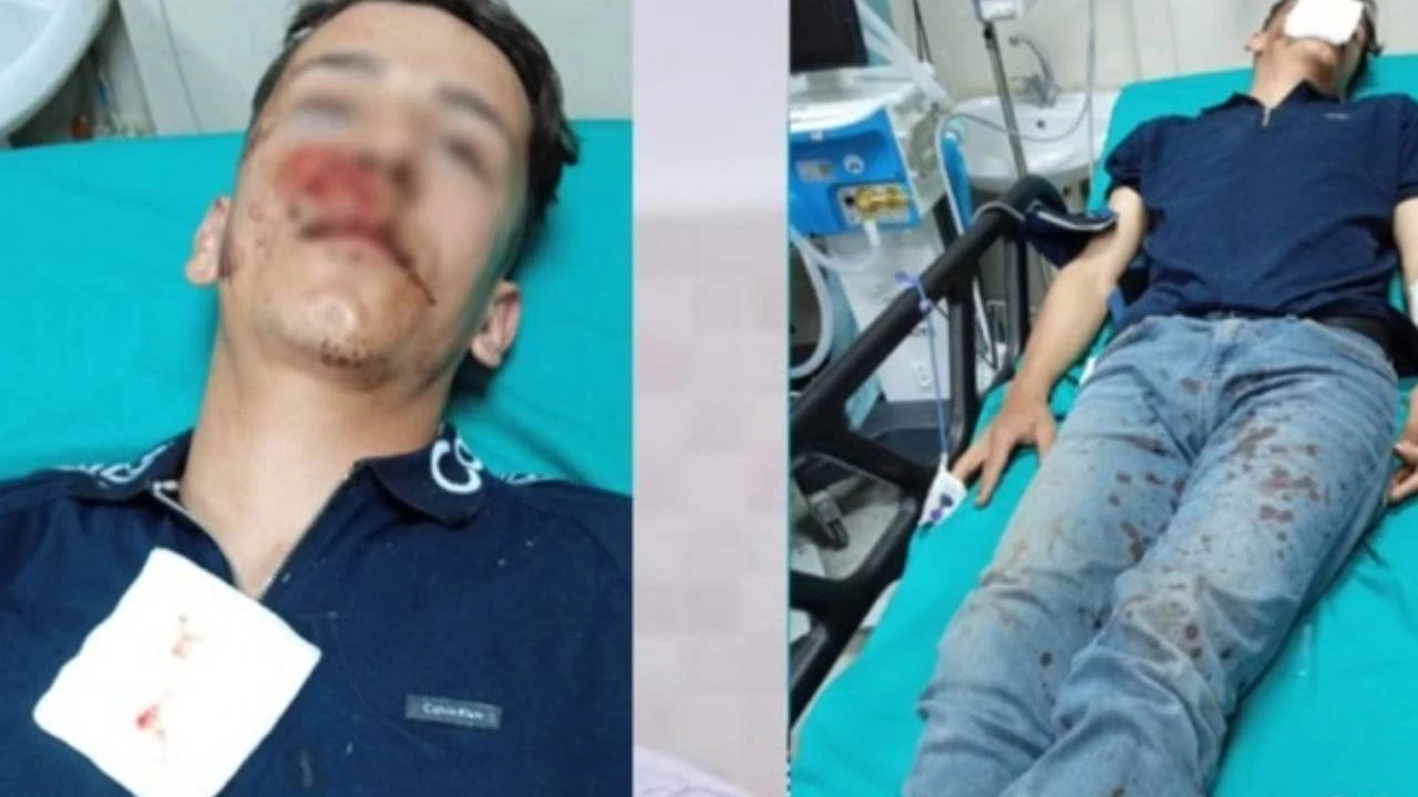 Hakkâri’de muhtar ve uzman çavuştan çocuğa şiddet