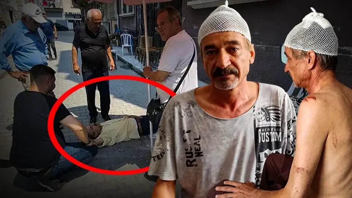 Sokakta çay içerken dehşeti yaşadı! Kafasına 11 dikiş atıldı