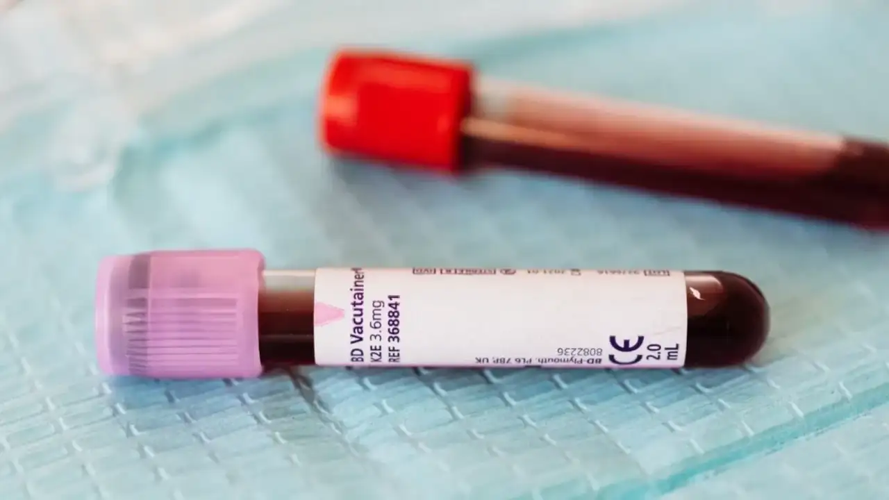 Dünya Hepatit Günü uyarısı: Milyonlarca kişi taşıyıcı olduğunu bilmiyor! Erken tanı hayat kurtarıyor