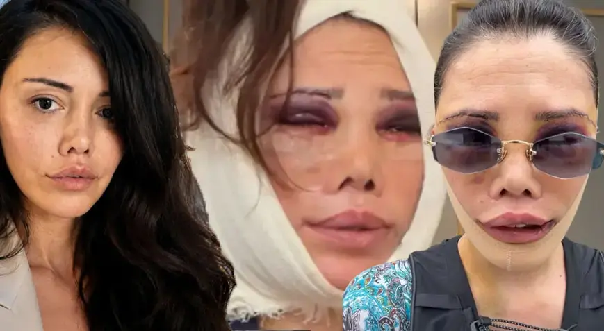 İkinci kez yüz nakli olmuştu! Didem Ceran’dan peş peşe çarpıcı açıklamalar: Hiç kimsem yok, tek başıma savaşıyorum