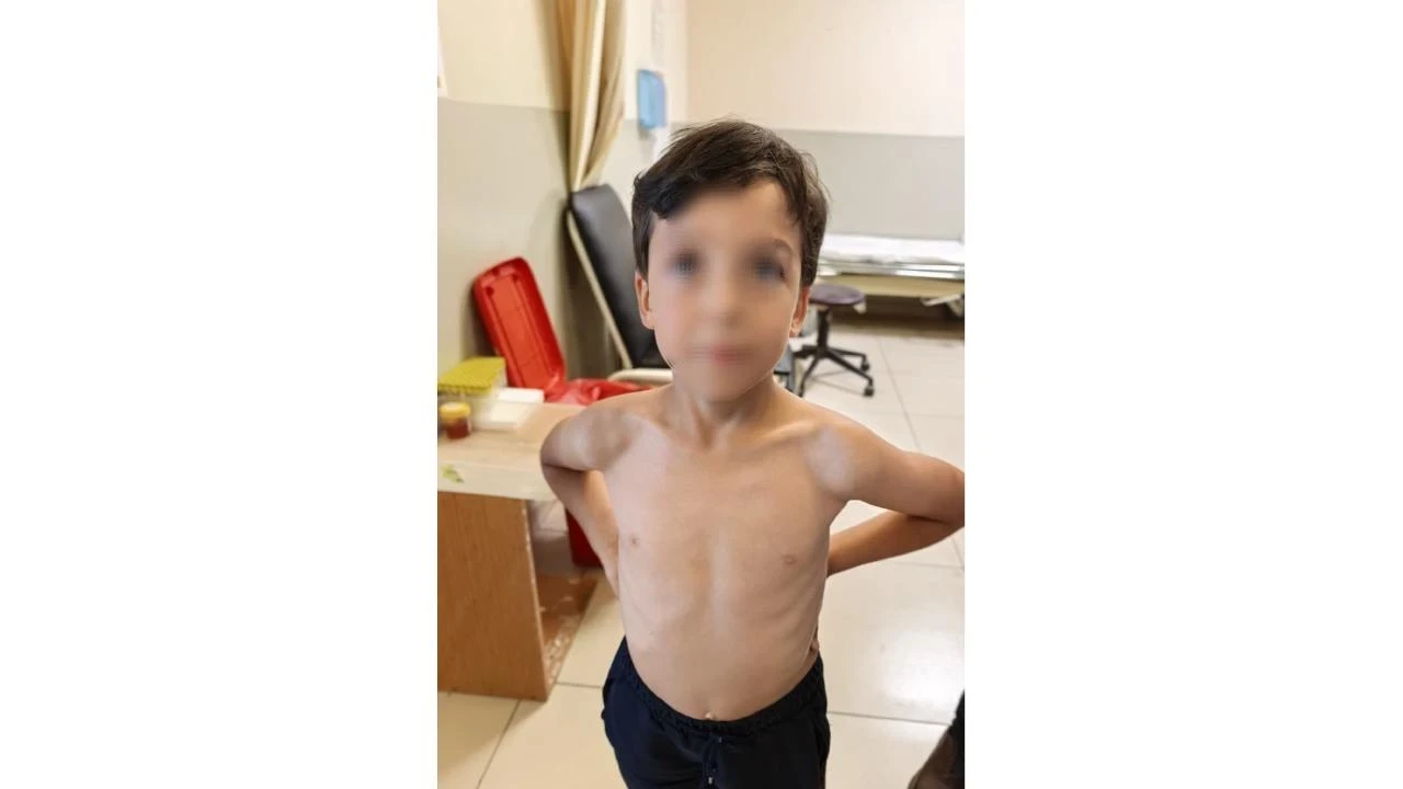 Çiftlikte oyun oynarken göğsüne kene yapıştı