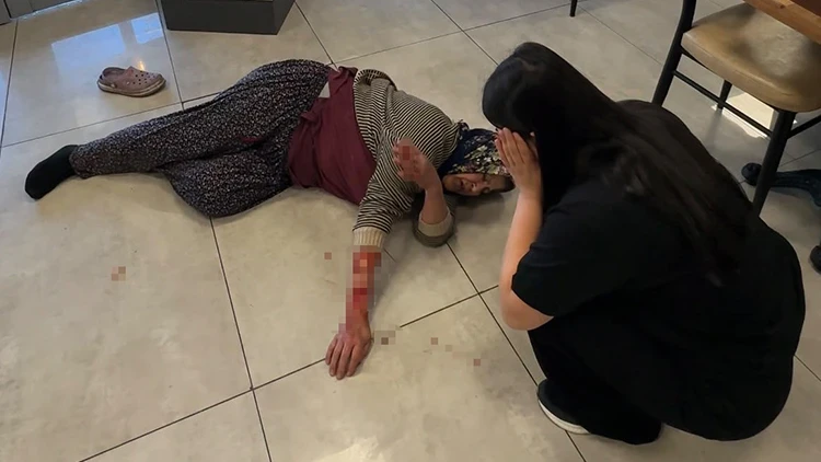Afyonkarahisar'da köpek saldırısında kadının kolu koptu